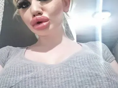 Вече става страшно: 18-а операция за българското Барби (След карантината пак ляга под ножа СНИМКИ)