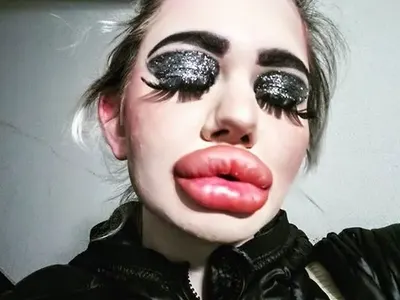 Вече става страшно: 18-а операция за българското Барби (След карантината пак ляга под ножа СНИМКИ)