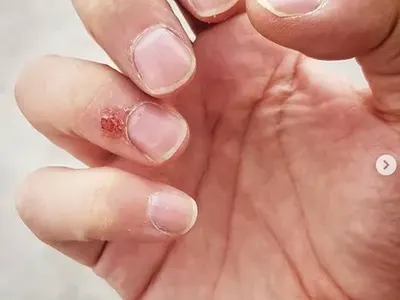 Защо Владо Карамазов си гризе кожичките на ноктите? (ШОК СНИМКА)