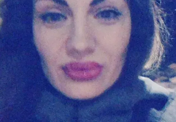 Брадърката Силвия залитна по пластичните операции