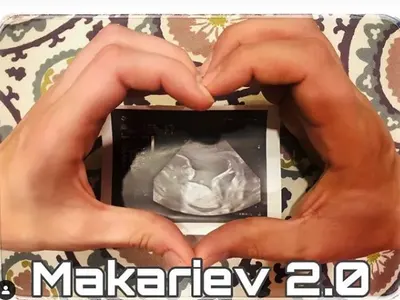 Бременната Луиза Григорова и мъжът й не могат да се разберат за пола на бебето