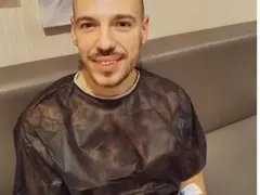 Дани Петканов си присади коса в Турция (Лудият репортер се бръкна само 1400 евро за процедурата)