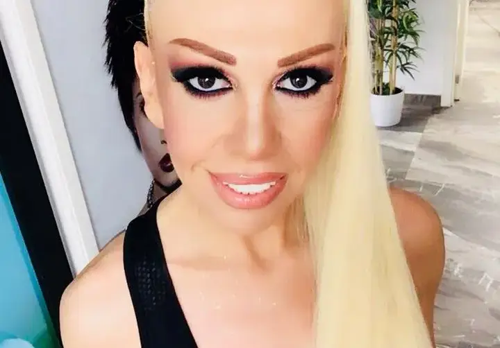 Луна с 15 пластични операции (Певицата си е махала ребра, оперирала си е клепачите и още)