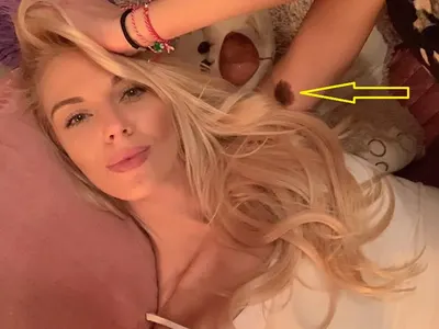 Натали Трифонова крие родилен белег