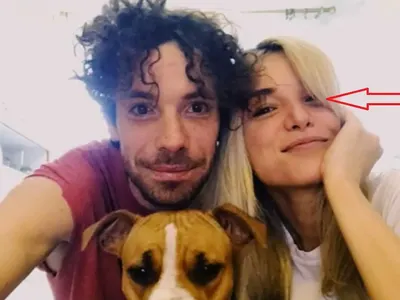 Рая Пеева цъфна с насинено око?