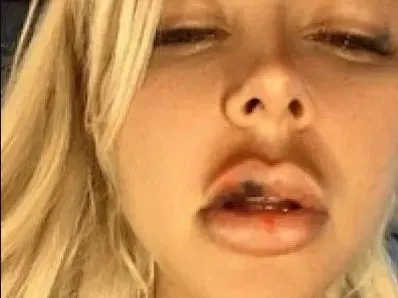 Андреа БИТА за 5 минути! Фенове: Не мълчи за насилието