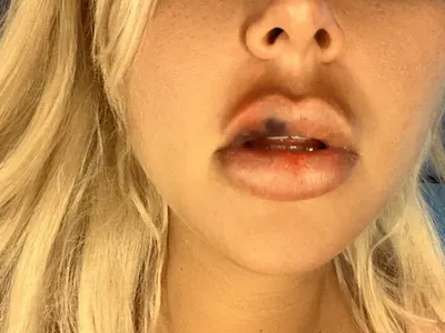 Ексклузивно в HotArena! Кобрата преби Андреа! (Фото)