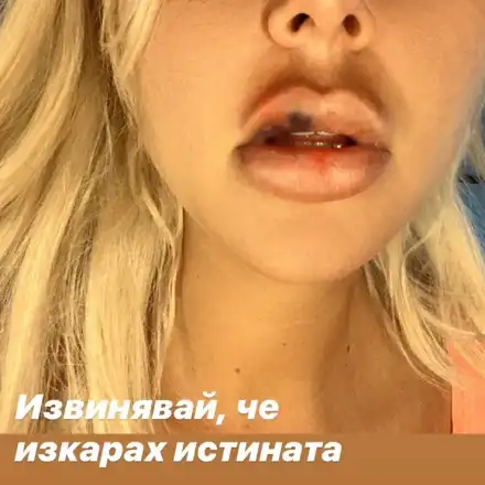 Ексклузивно в HotArena! Кобрата преби Андреа! (Фото)