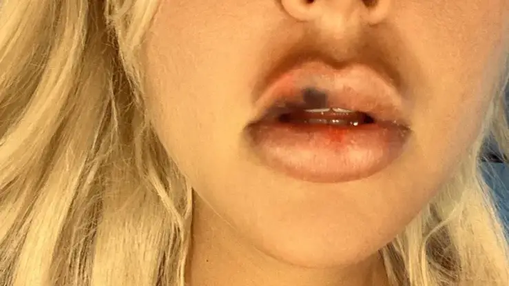 Ексклузивно в HotArena! Кобрата преби Андреа! (Фото)