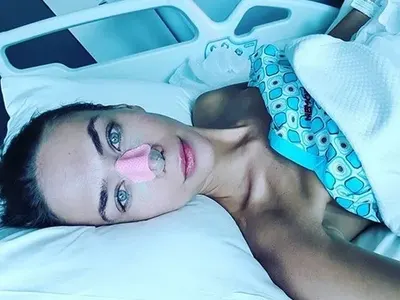 Гаджето на Башар с 12 операции на носа, присадиха й хрущял от ребро (Фото от операционната)