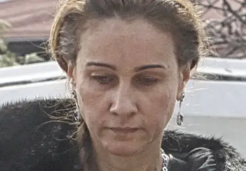 Радост Драганова куца с пирон в крака, след като скиор я помете и потроши в Боровец