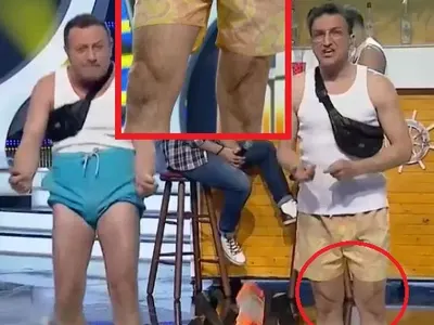 Зуека крие ЖЕСТОКА операция на краката! Комикът изплаши с брутални белези по коленете (СНИМКИ отблизо)