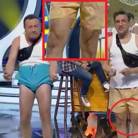 Зуека крие ЖЕСТОКА операция на краката! Комикът изплаши с брутални белези по коленете (СНИМКИ отблизо)