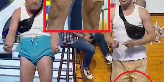 Зуека крие ЖЕСТОКА операция на краката! Комикът изплаши с брутални белези по коленете (СНИМКИ отблизо)