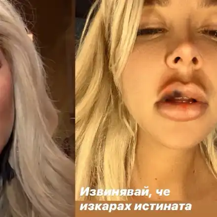 Андреа съди Кобрата за домашно насилие (Певицата редовно е отнасяла шамари от боксьора)