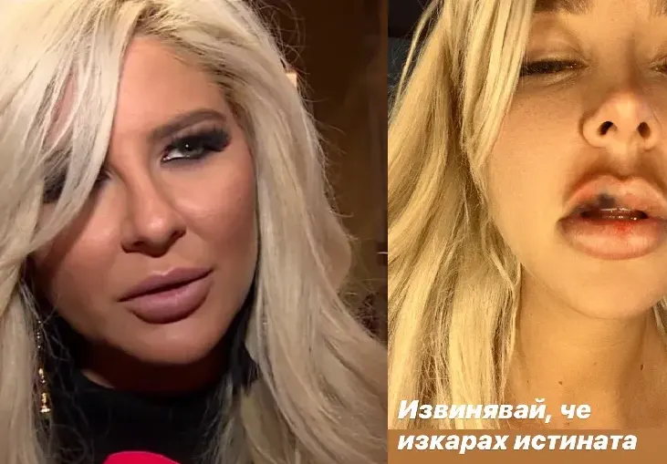 Андреа съди Кобрата за домашно насилие (Певицата редовно е отнасяла шамари от боксьора)