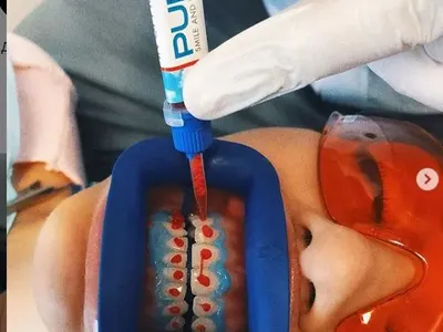 Джулиана Гани шашна със зъболекарско селфи