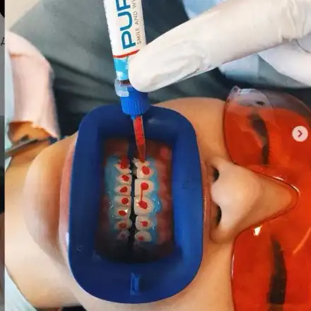 Джулиана Гани шашна със зъболекарско селфи