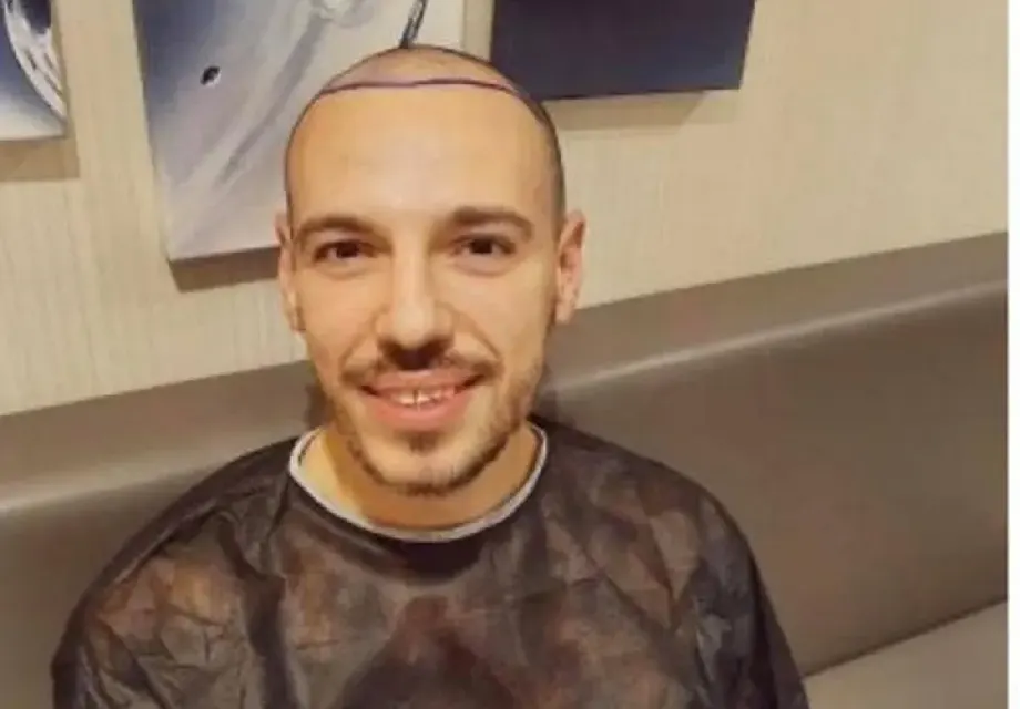 И присадената коса на Даниел Петканов окапа