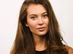 Разобличена! Никол Станкулова лъже, че устните й са естествени