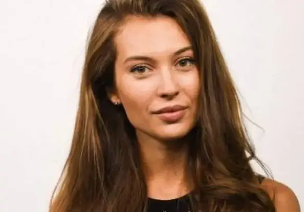 Разобличена! Никол Станкулова лъже, че устните й са естествени