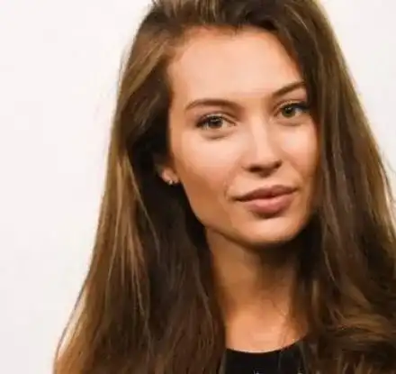 Разобличена! Никол Станкулова лъже, че устните й са естествени