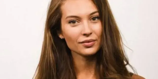 Разобличена! Никол Станкулова лъже, че устните й са естествени
