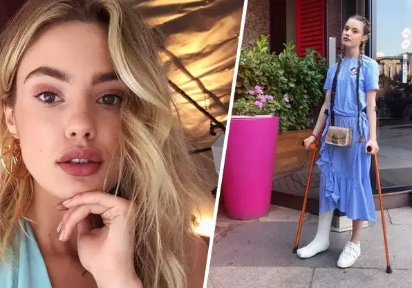 Кристин Илиева маха белезите си (Всеки от тях й напомнял за катастрофата)