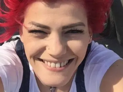 Жана Бергендорф оперира носа си по спешност (Дрогата скапа обонятелния орган на певицата)