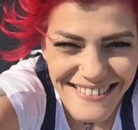 Жана Бергендорф оперира носа си по спешност (Дрогата скапа обонятелния орган на певицата)