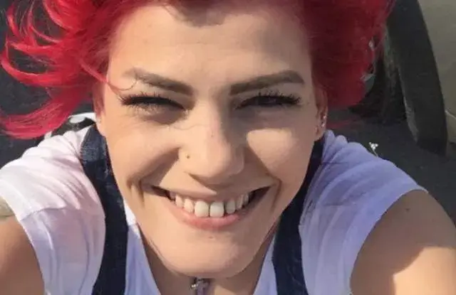 Жана Бергендорф оперира носа си по спешност (Дрогата скапа обонятелния орган на певицата)