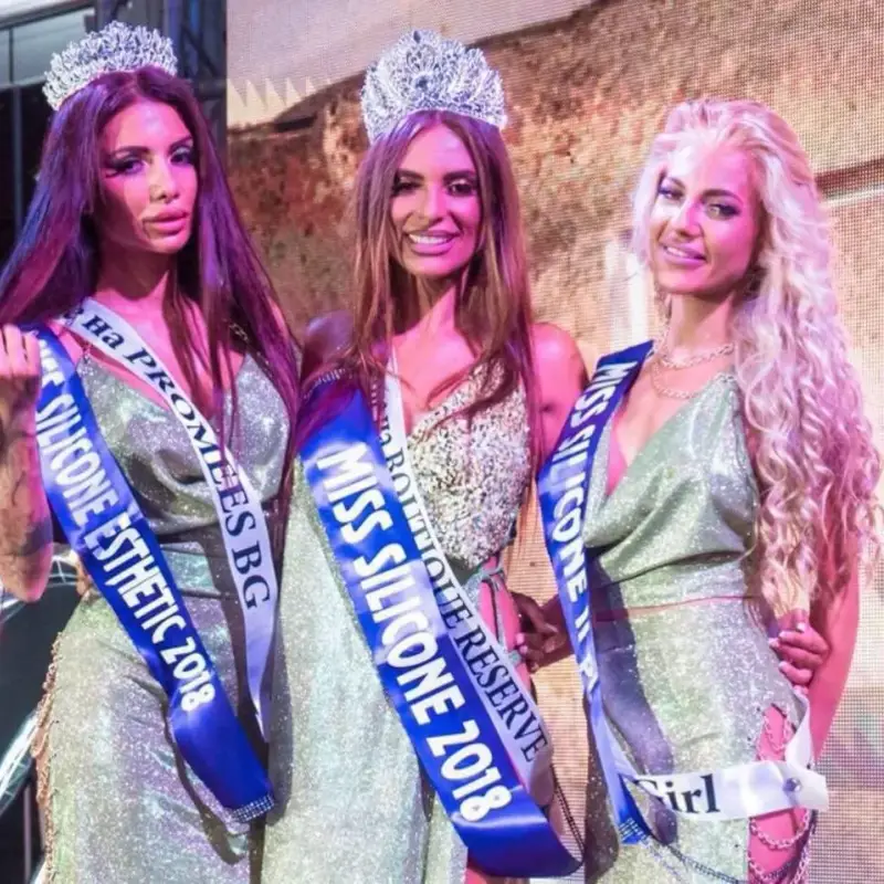 Мацка с 12 пластични операции и медицинска сестра атакуват „Мис Силикон“