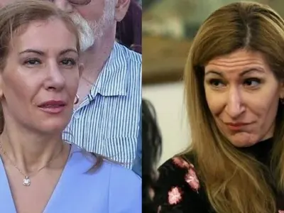 Ангелкова не е сама! Кои популярни личности са неузнаваеми след операции на носовете си ? (Уникални снимки)