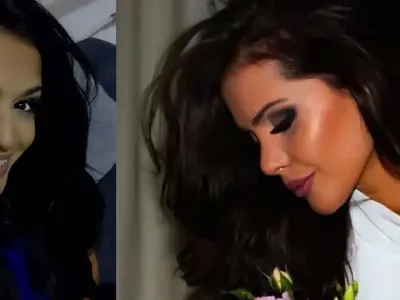 Ангелкова не е сама! Кои популярни личности са неузнаваеми след операции на носовете си ? (Уникални снимки)