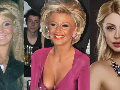 Ангелкова не е сама! Кои популярни личности са неузнаваеми след операции на носовете си ? (Уникални снимки)