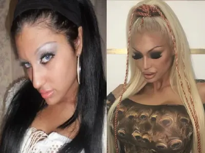 Ангелкова не е сама! Кои популярни личности са неузнаваеми след операции на носовете си ? (Уникални снимки)