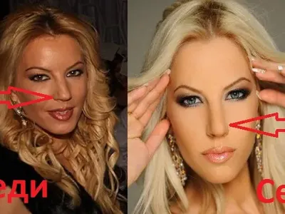 Ангелкова не е сама! Кои популярни личности са неузнаваеми след операции на носовете си ? (Уникални снимки)