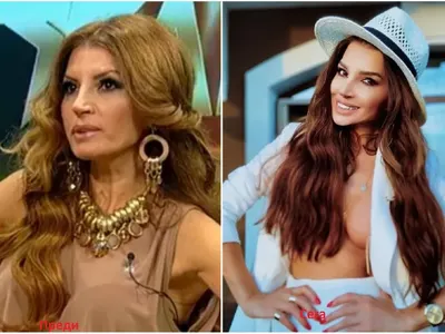 Ангелкова не е сама! Кои популярни личности са неузнаваеми след операции на носовете си ? (Уникални снимки)