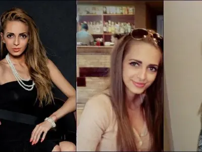 Ангелкова не е сама! Кои популярни личности са неузнаваеми след операции на носовете си ? (Уникални снимки)