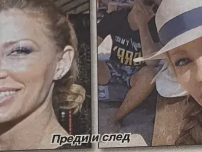 Ирен Онтева с нов нос за юбилея (Снимки „преди и сега“)