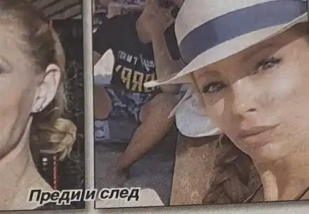 Ирен Онтева с нов нос за юбилея (Снимки „преди и сега“)