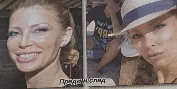 Ирен Онтева с нов нос за юбилея (Снимки „преди и сега“)