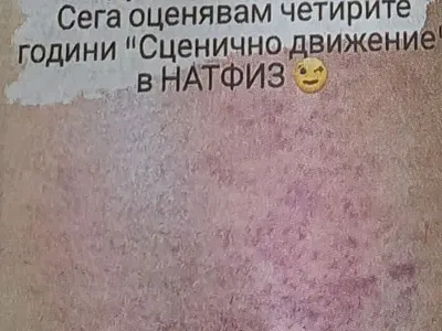 Кая Райков от „Откраднат живот“ се преби жестоко с тротинетка (Снимки)