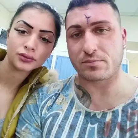 Мутри пребиха плеймейтка, 4 месеца Катрин се храни със сламка (Разказ от първо лице)