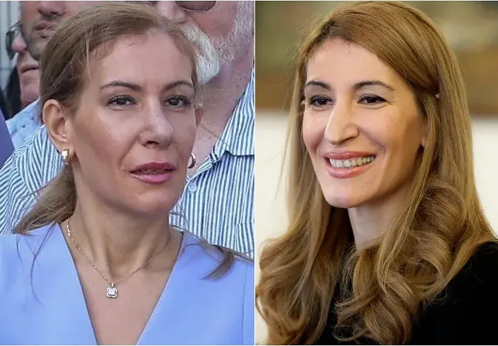 Николина Ангелкова си оперира носа за малко над 6 бона (Екс министърката търпяла подигравки 35 години)