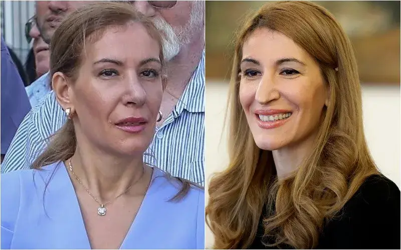 Николина Ангелкова си оперира носа за малко над 6 бона (Екс министърката търпяла подигравки 35 години)