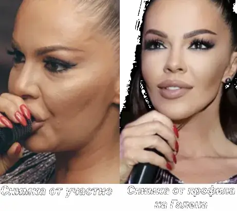 Галена е новата Андреа! Вижте как замазва дефекти с „вълшебната“ баданарка
