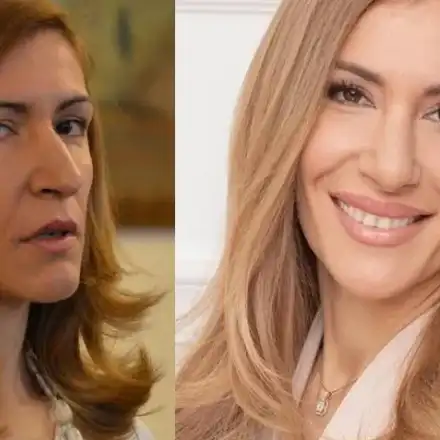 Спукаха от бъзици Ангелкова за новия й нос: За министър не ставаше, но сега може да се явиш за Мис Плеймейт (Снимки)