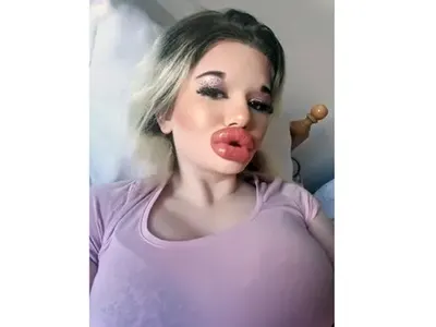 Вирусът не плаши БГ Барби! Пожела си силиконови бомби за ЧРД (СНИМКИ)