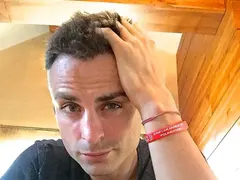 Бербо не спира да се гали по присадената коса, не може да й се нарадва